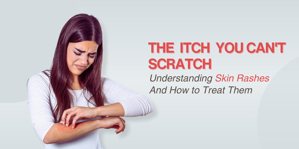 The Itch You Can T Scratch Understanding Skin Rashes