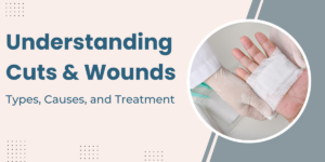 Understanding Cuts & Wounds Types, Causes, Treatment, and Over-the-Counter Options