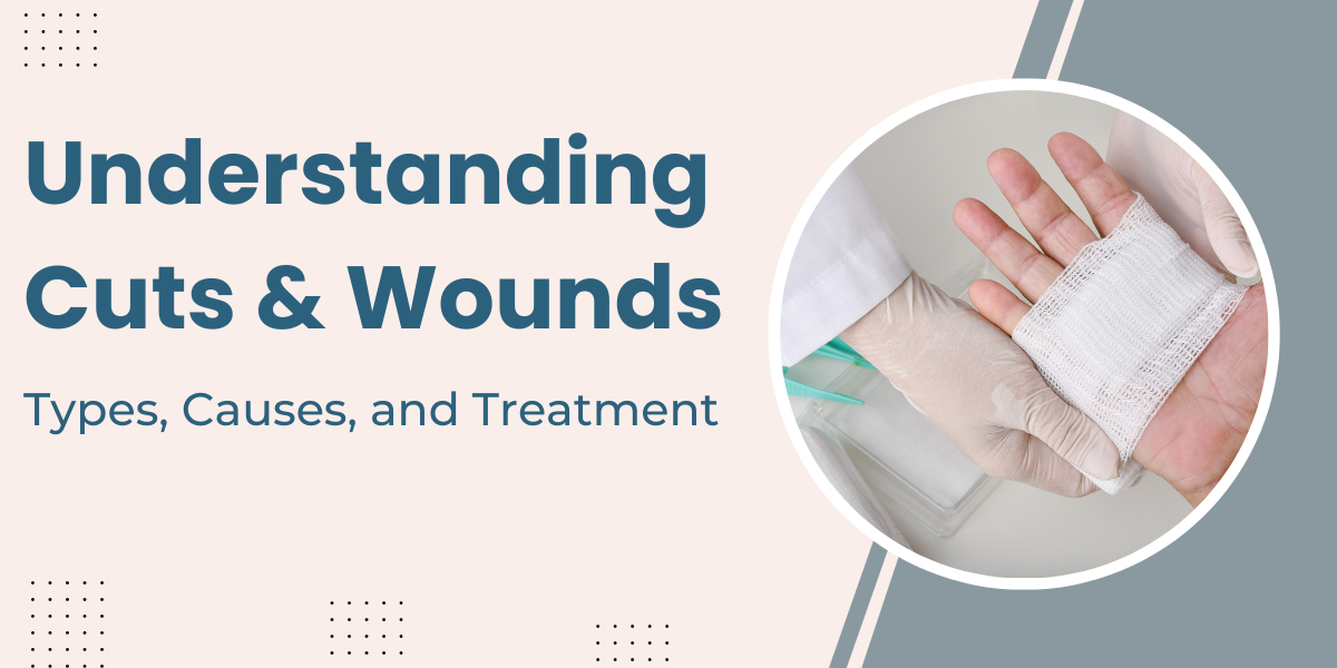 Understanding Cuts & Wounds: Types, Causes, Treatment, and Over-the ...