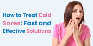 How to Treat Cold Sores Fast and Effective Solutions